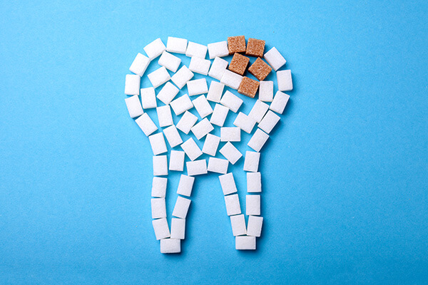 4 Common General Dentistry Treatments for Cavities