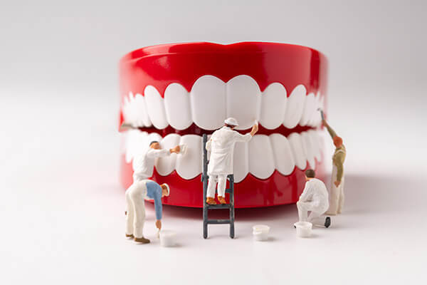 model of dentures