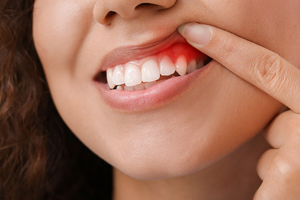 lady showing gums