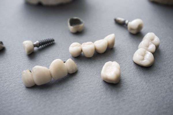 Types of Dental Implants