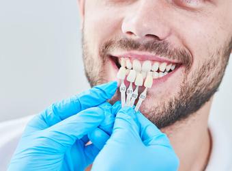 How Dental Veneers Are Used in General Dentistry