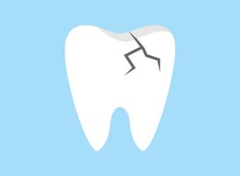 General Dentistry Treatments for a Damaged Tooth